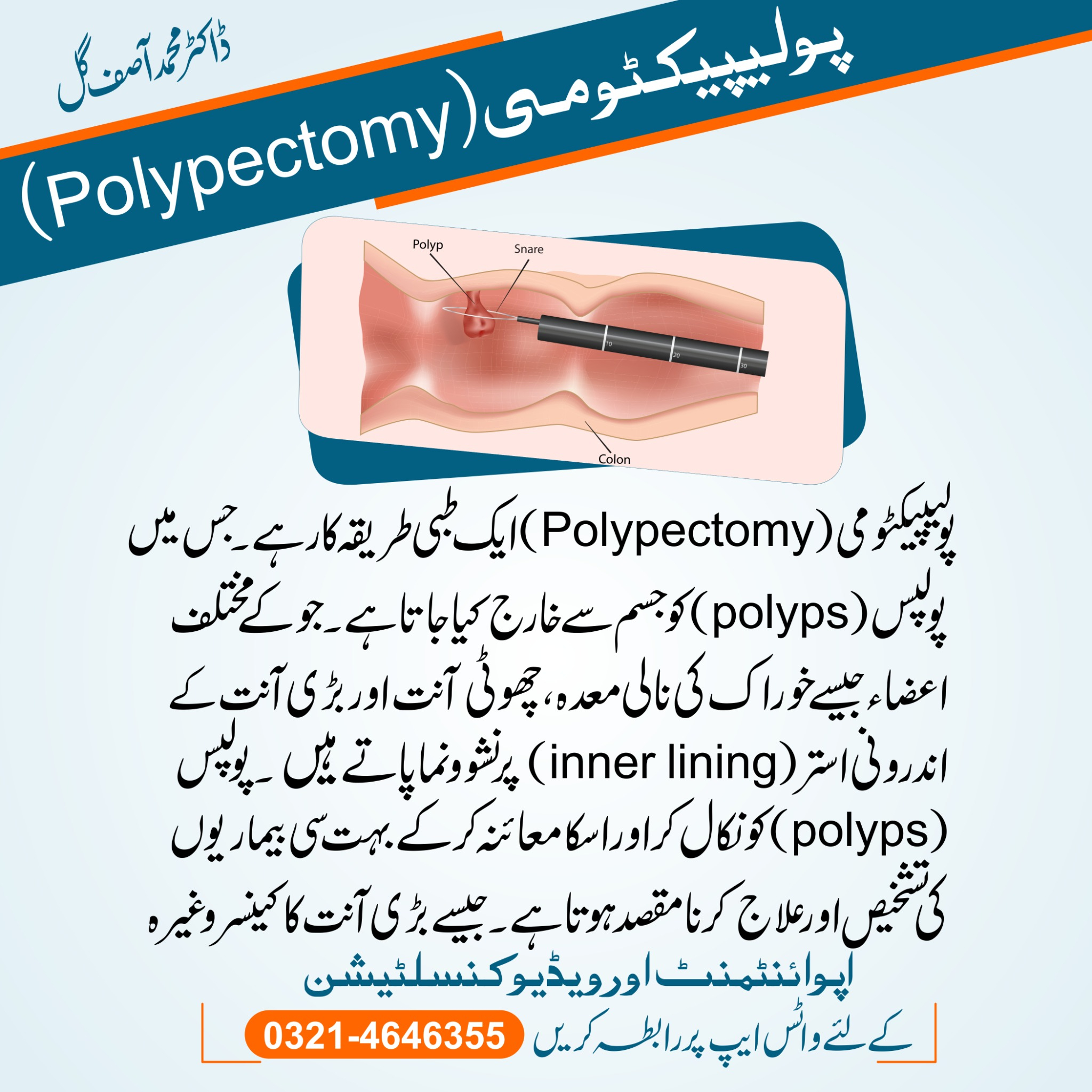 Removal of Polyps through polypectomy